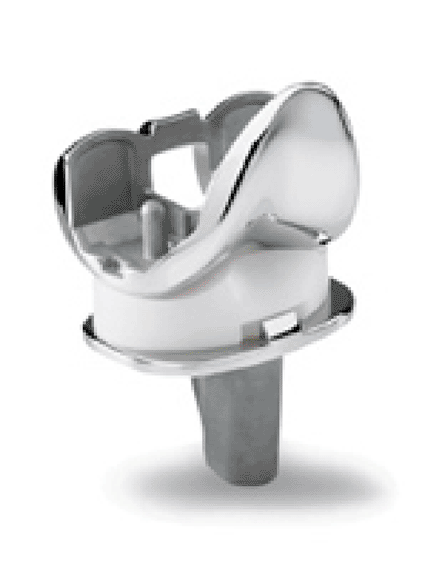 Image: Zimmer NexGen LPS-Flex Mobile bearing knee (photo courtesy Zimmer Holdings).
